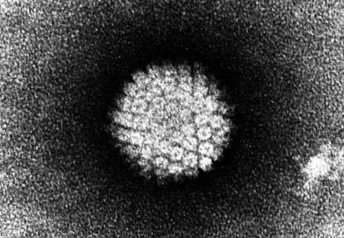 Папилломовирус под микроскопом